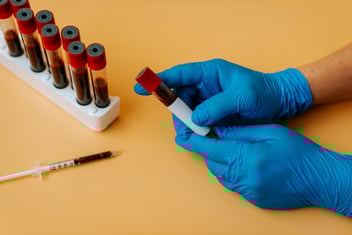 Blood Collection