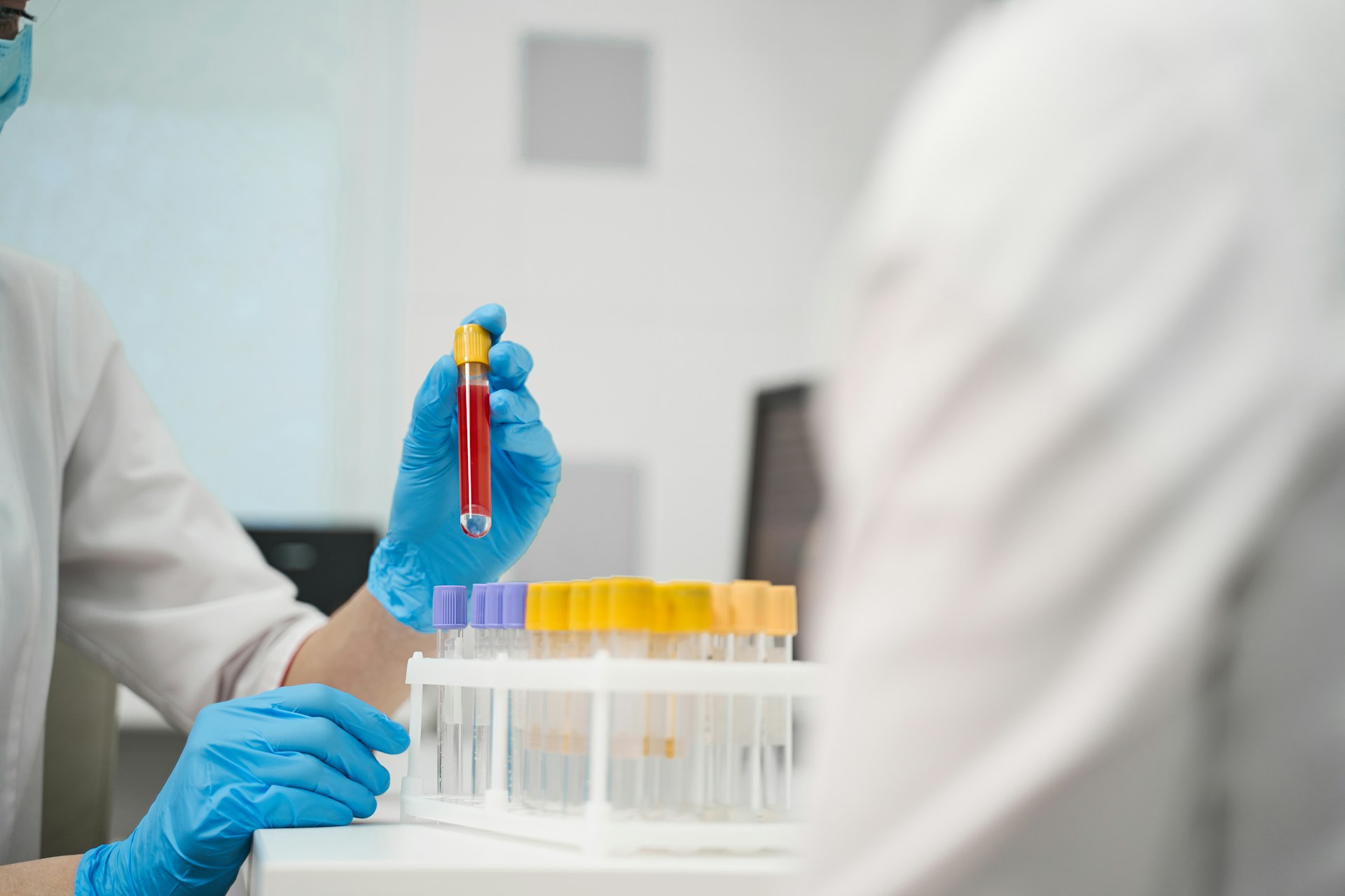 Blood Sample